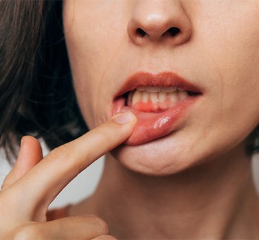 Woman with irritated gums.