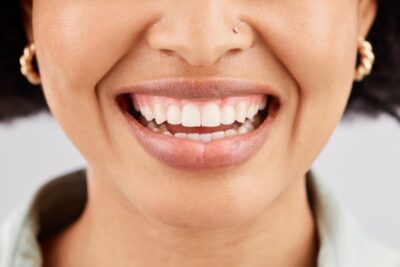 Close-up of a woman’s smile.